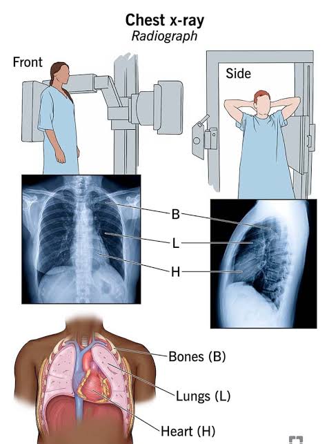 Xray Services